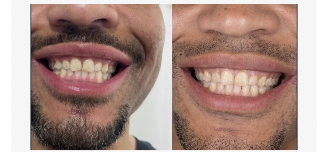 Before and after — Courtney