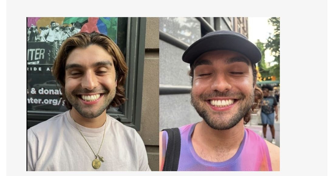 Before and after — Thomas
